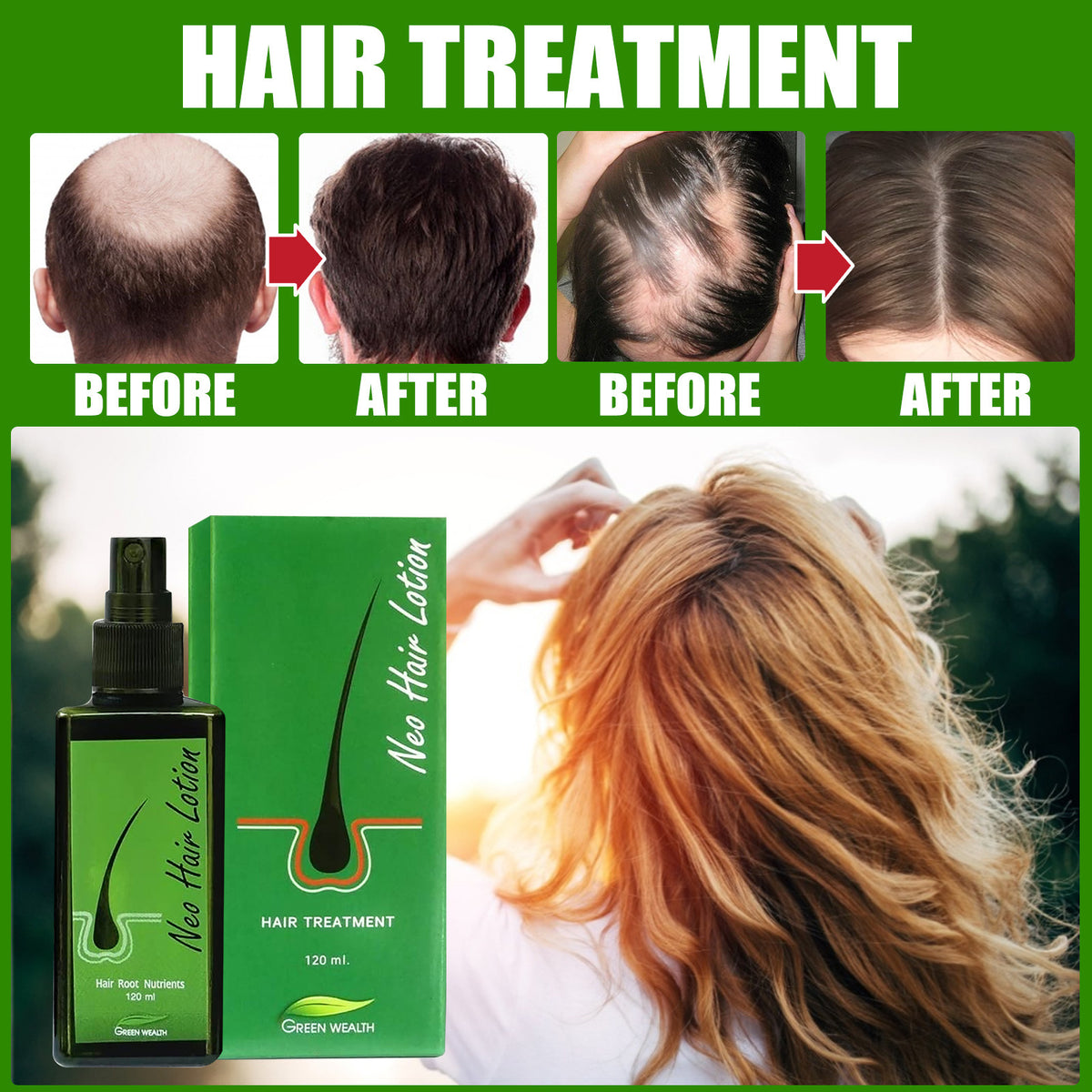 Hair Growth Lotion Spray 120ml