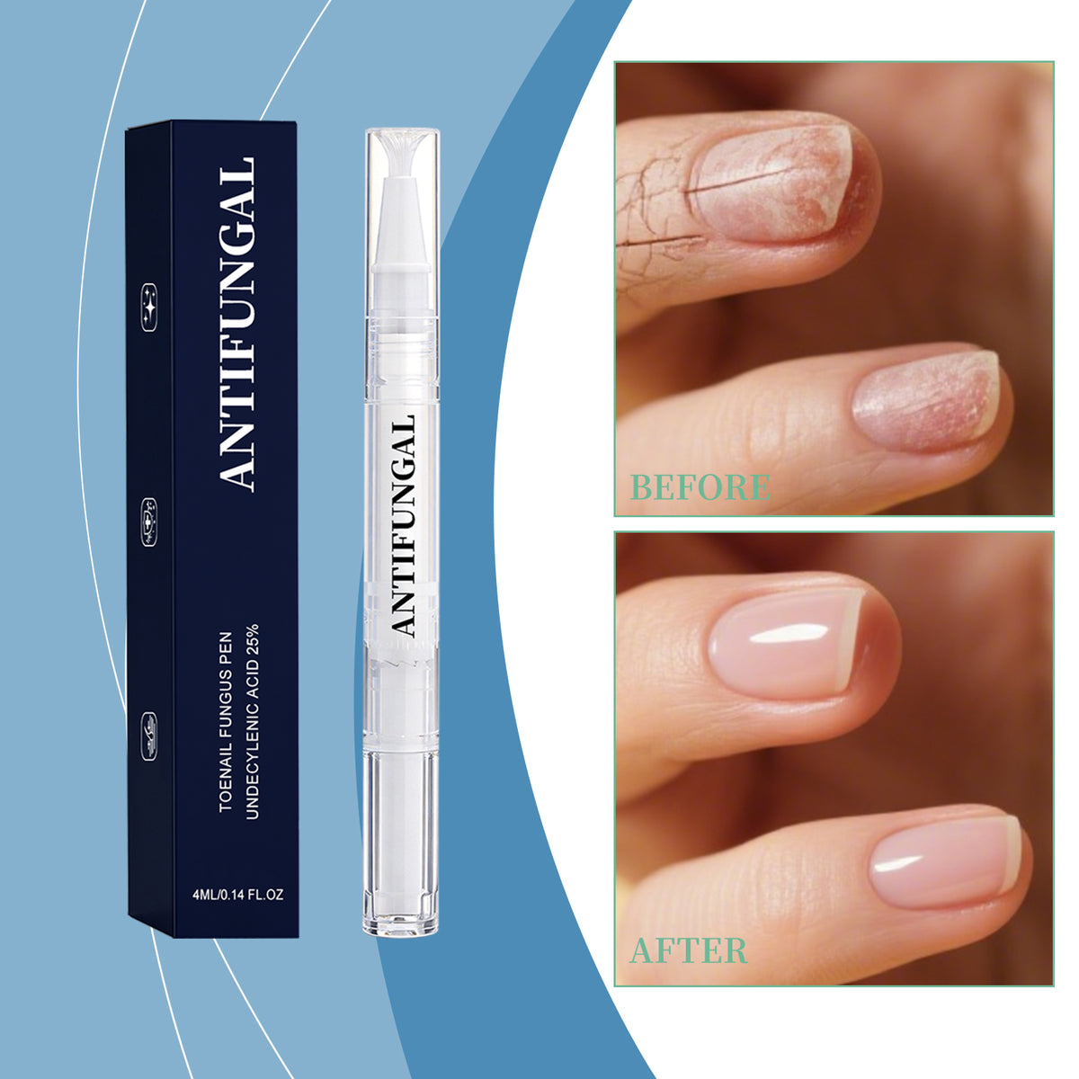 Nail Art Kit Nail Care Pen 4ml for DIY Manicure & Pedicure