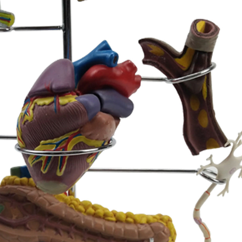 Diabetes Pathology Teaching Model - Medical Education Demonstration Tool