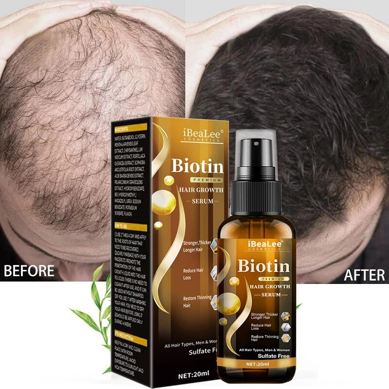 Anti Hair Loss Serum Essence Liquid 20ml