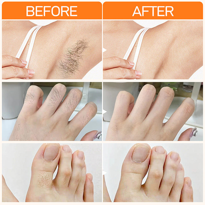 Men and Women Lip Hair Removal Cream - Gentle Facial Depilatory 20g