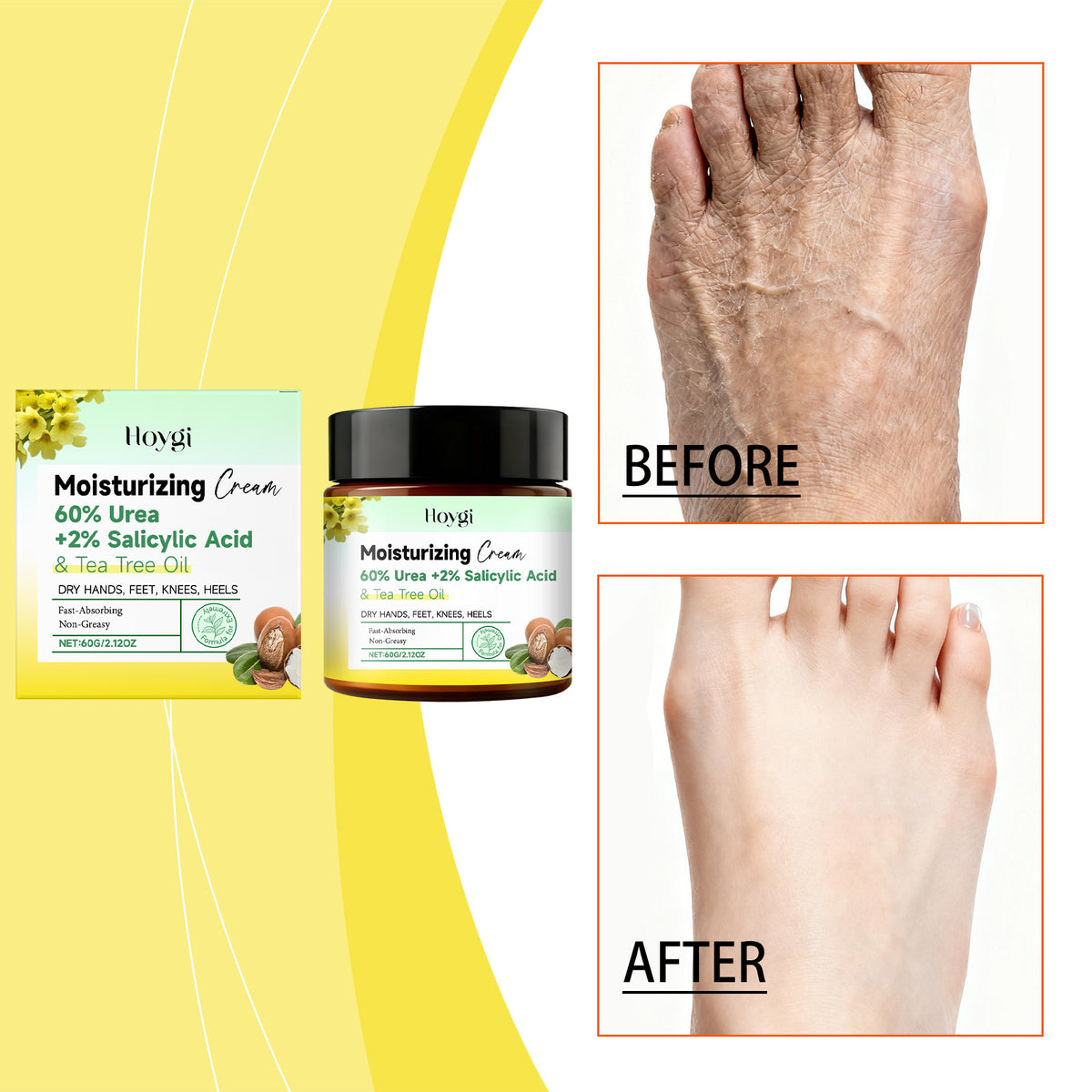 Urea Hand & Foot Moisturizing Cream - 60g