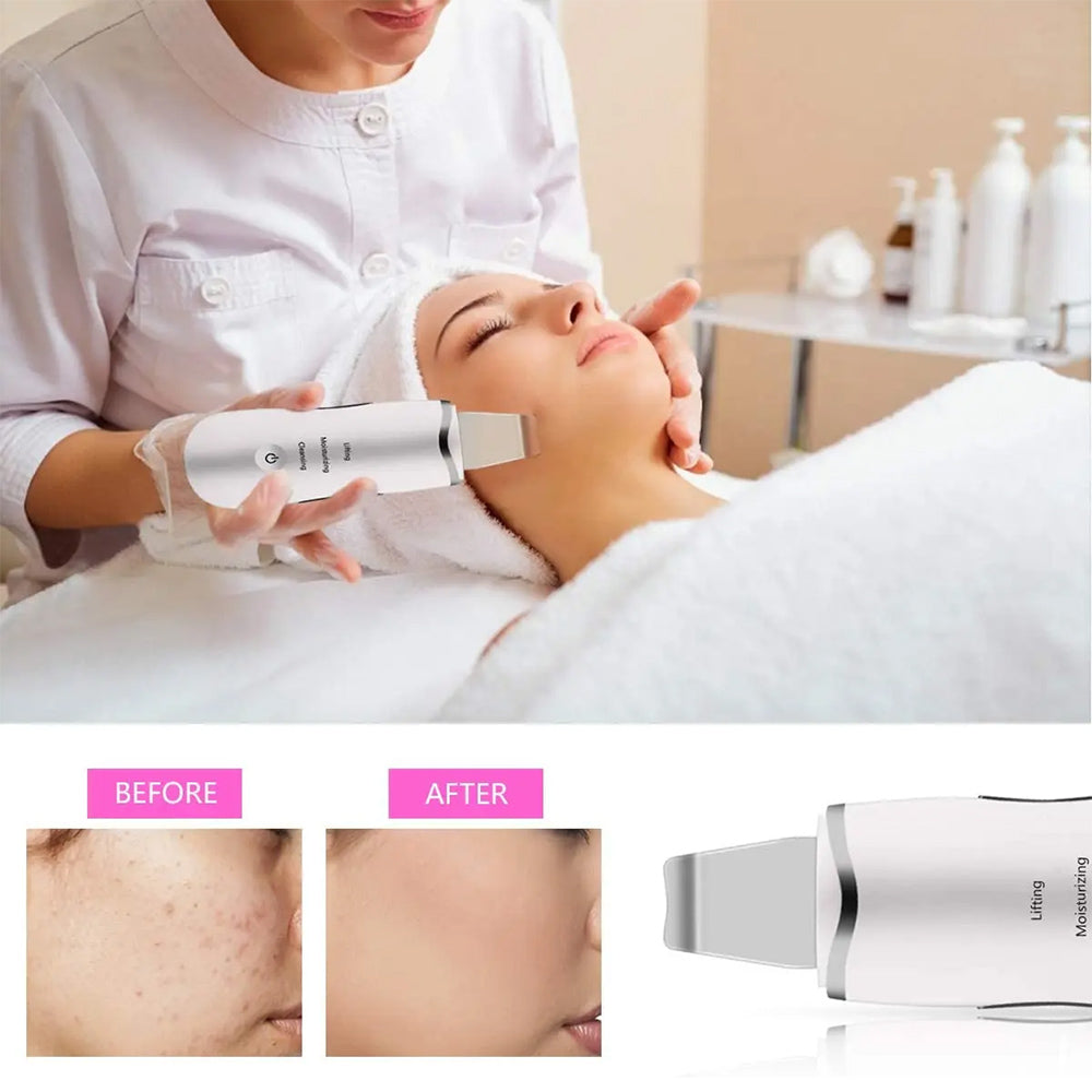 3-in-1 Ultrasonic Facial Spatula - Deep Cleansing Skin Scrubber Tool