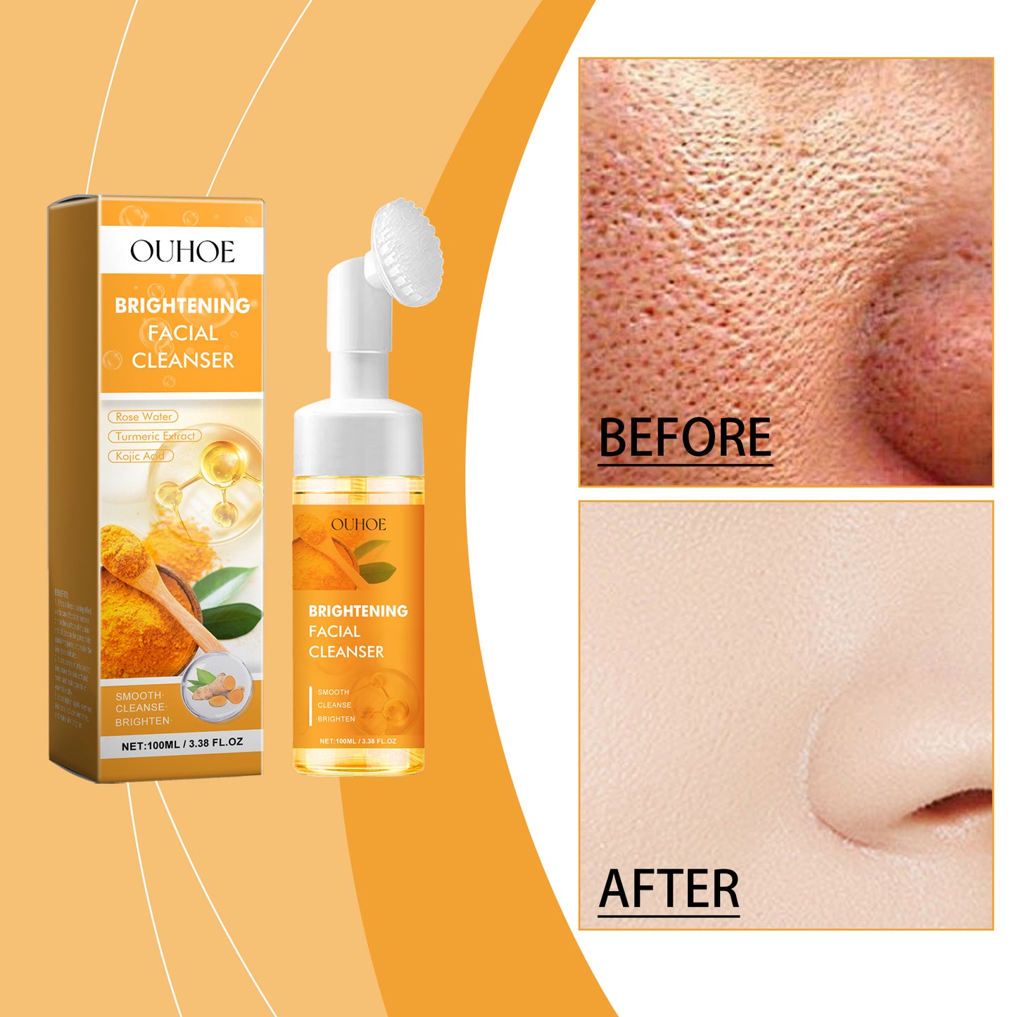 Turmeric Facial Cleanser with Built-in Brush Head - 100ml Acne Care