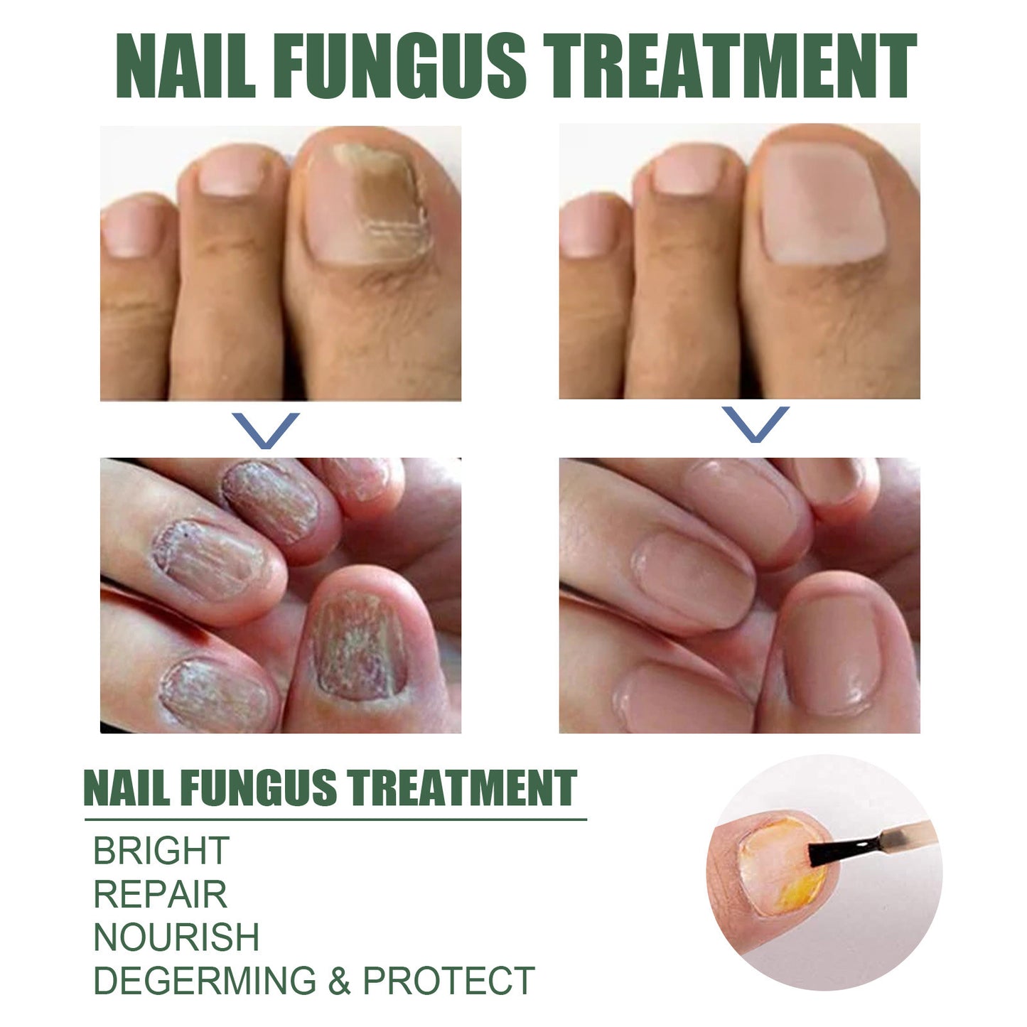 Nail Care Liquid for Cleaning Fingernails and Toenails - 30ml & 50ml Options