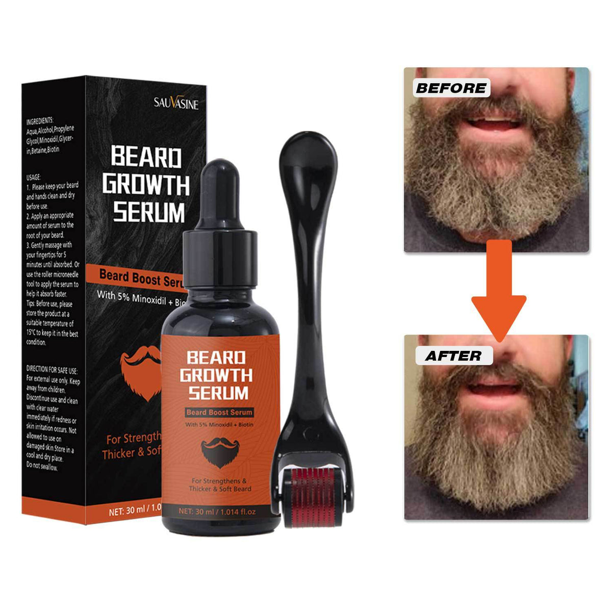 Beard Microneedle Roller & 30ml Beard Serum Set - Facial Grooming