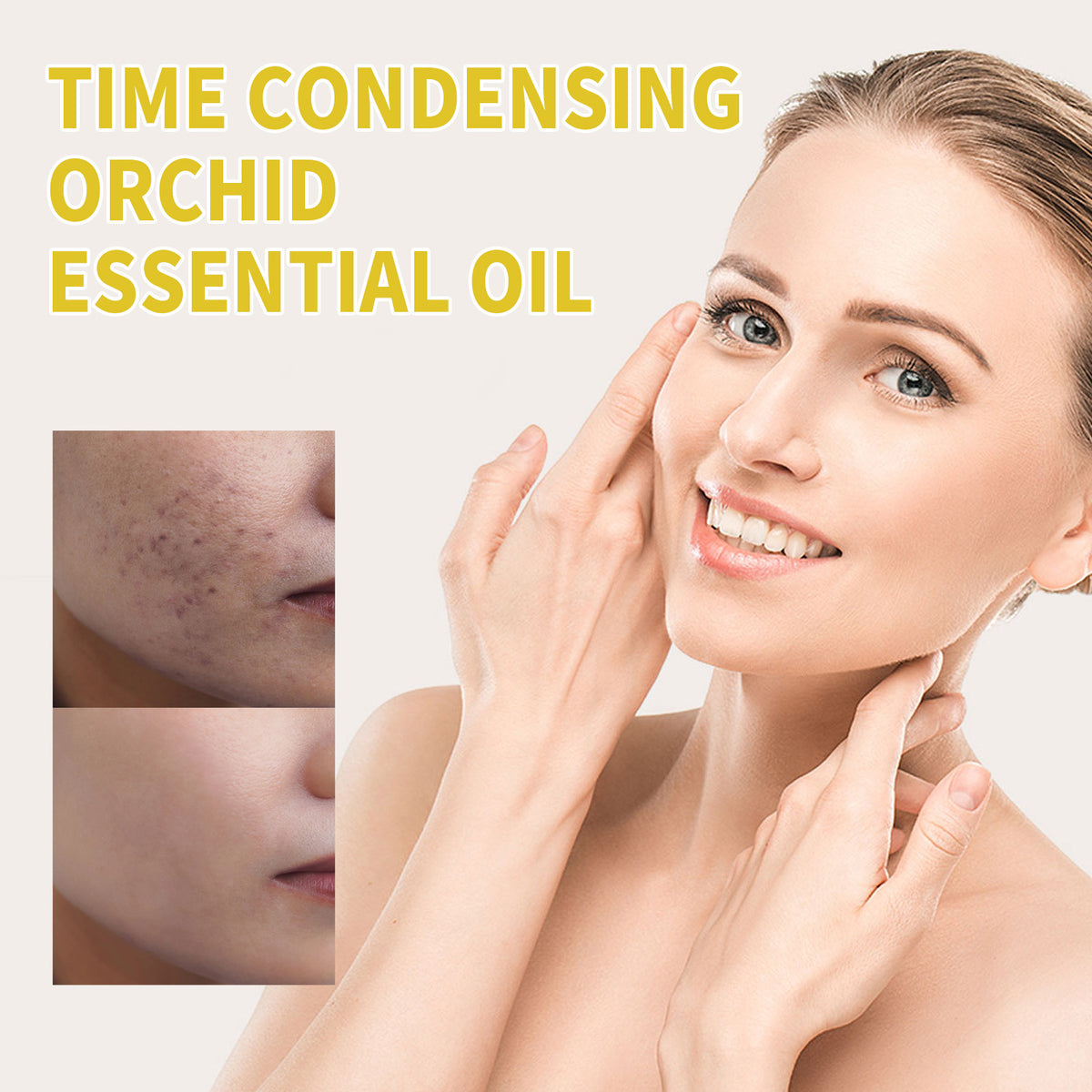 Acne Treatment Oil for Facial Cleansing & Brightening - 30ml