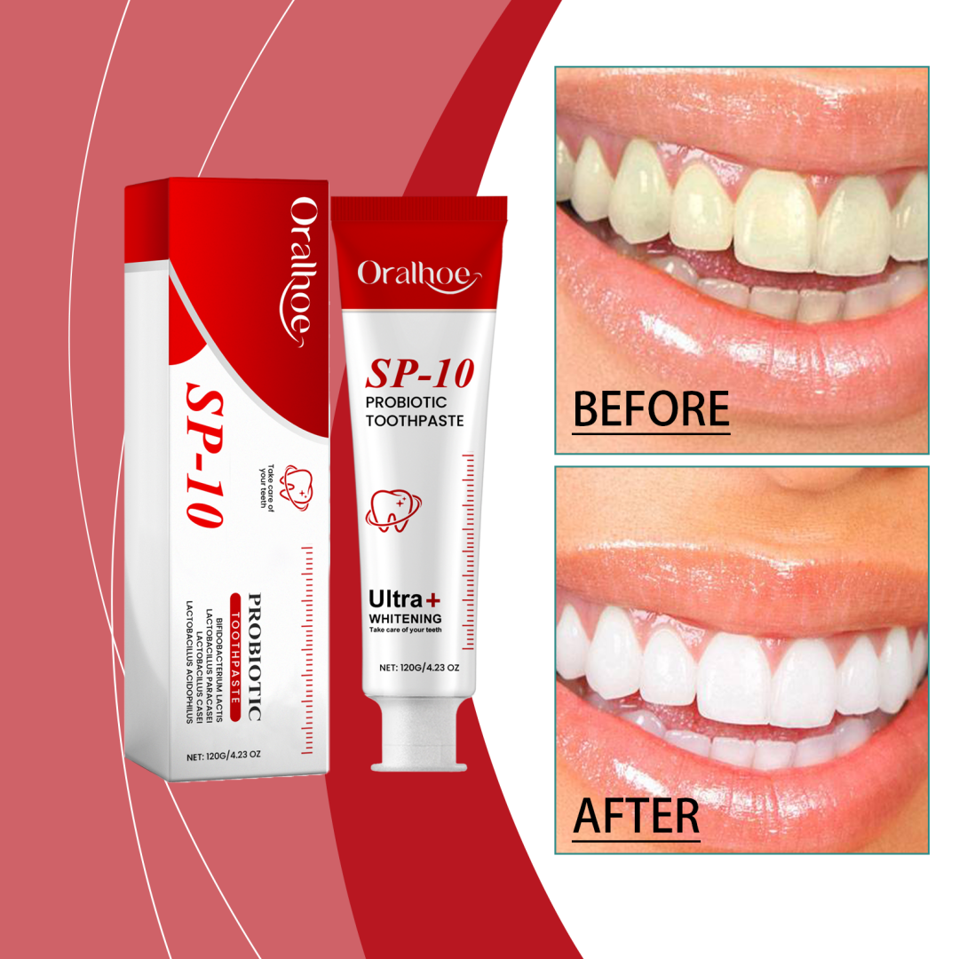Probiotic Whitening Toothpaste 120g - Deep Stain Removal & Gentle Oral Care