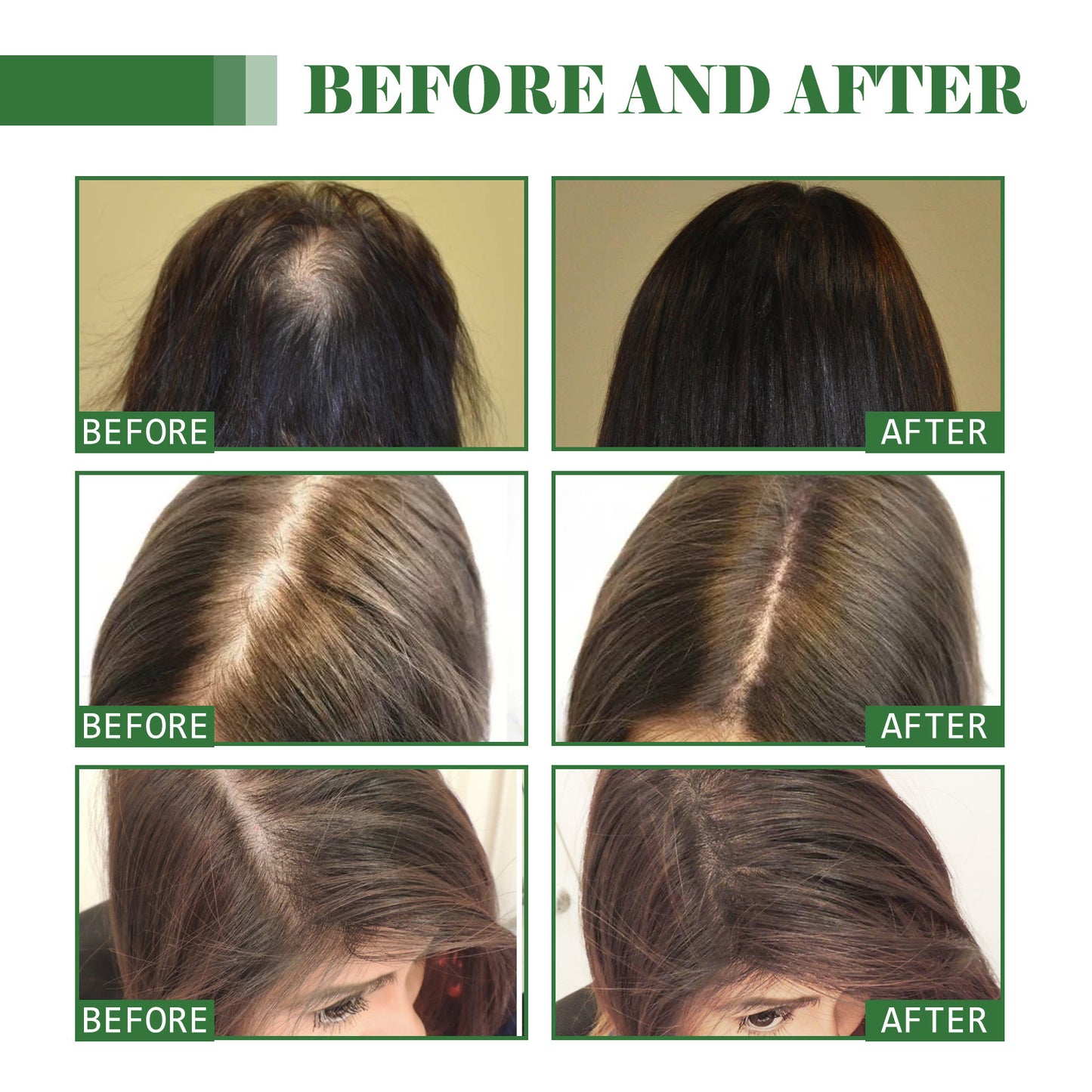 Moisturizing Hair Growth Treatment Oil - 100ml Hair Repair Serum