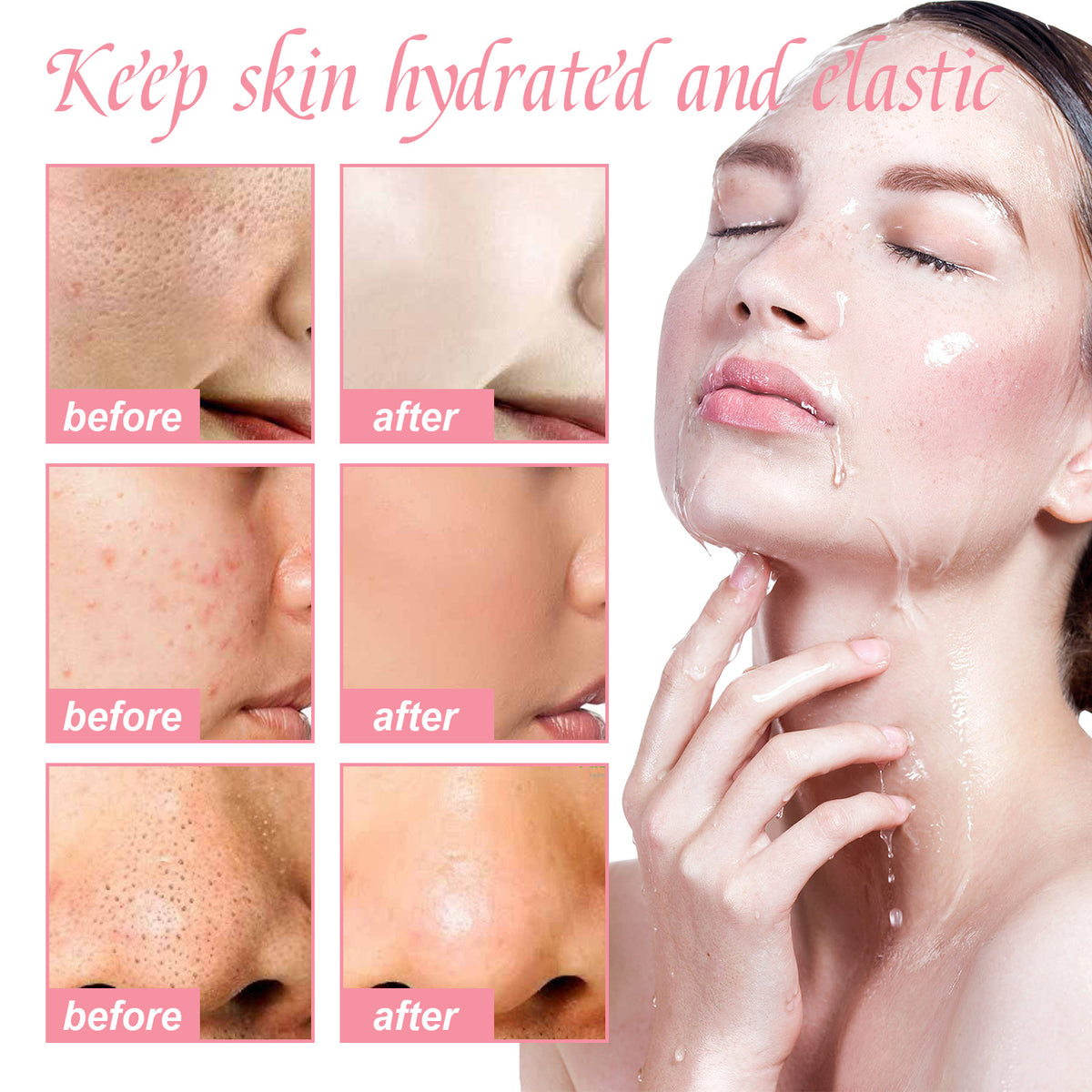 Watermelon Cream Facial Moisturizer for Skin Repair - 50ml