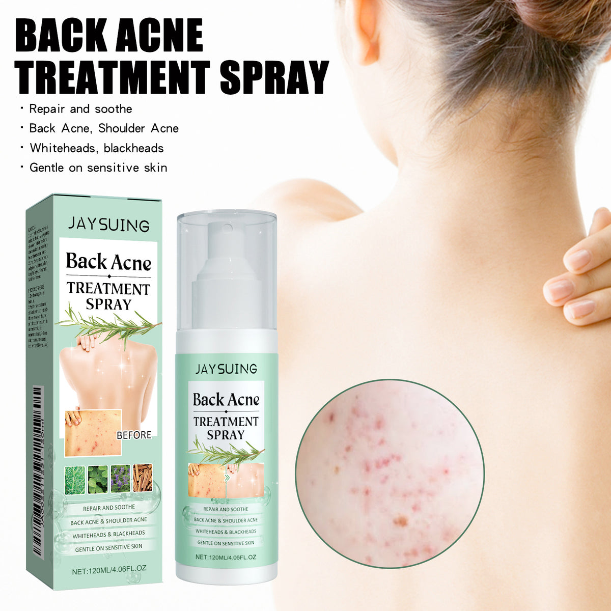 Acne Cleansing Spray - Back & Body Care - 120ml
