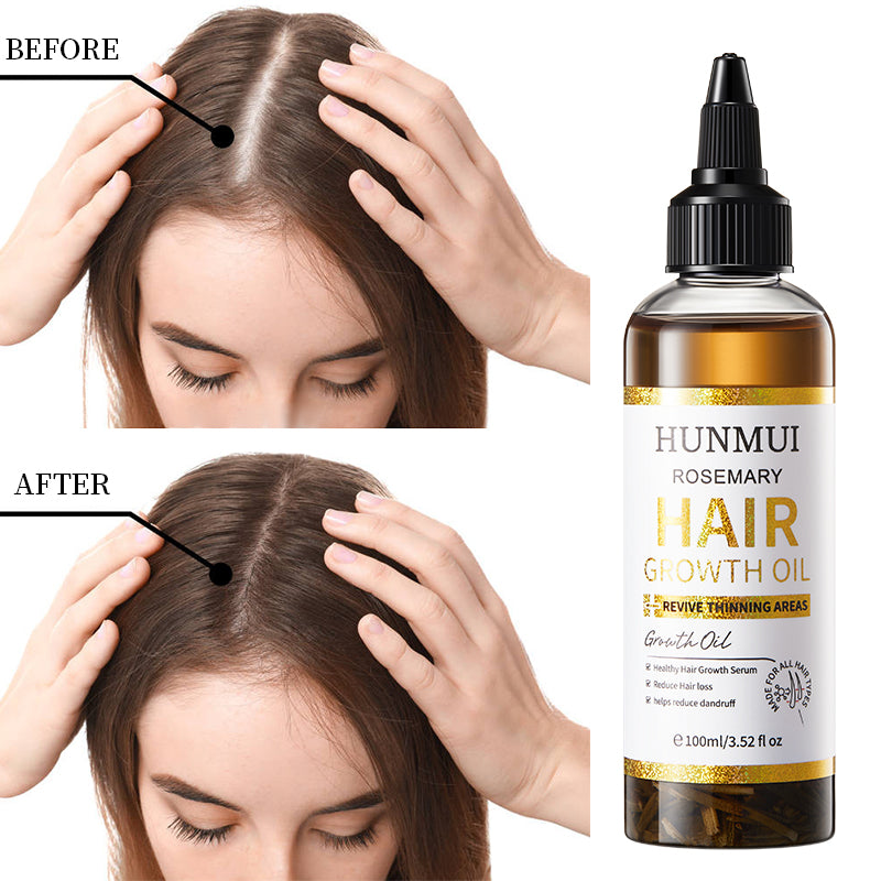 Rosemary Hair Growth Oil 100ml