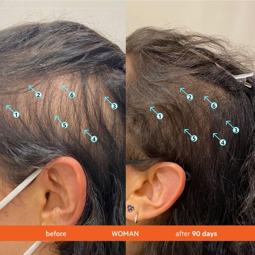 DS Labs Revita Shampoo & Conditioner Kit, 205mL – Scalp First System for Fuller Looking, Volumized Hair, Lightweight Hydration, Sulfate & Silicone Free, Color Safe, For Men & Women