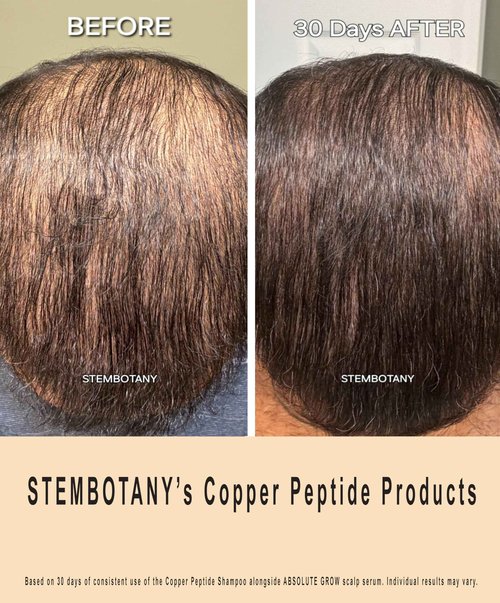 STEMBOTANY Copper Peptide Hair Shampoo for Men and Women Promotes the Look of Thicker, Fuller and Healthier Hair