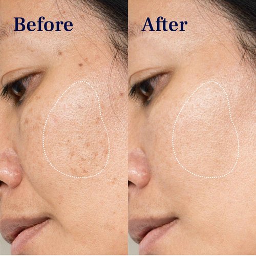 Pureance Balance & Brighten Set - Dark Spot Corrector & Hydrating Serum