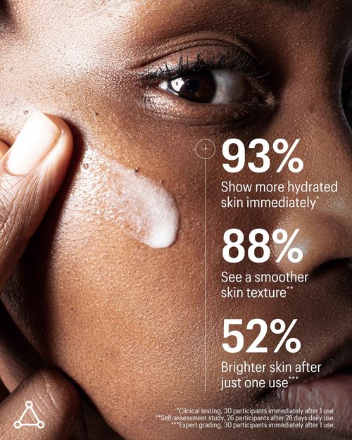 Allies of Skin Azelaic & Kojic Clarifying Face Serum | Clinically Proven for Acne & Blemish Prone Skin |10% Azelaic Acid Treats Pigmentation and Redness | Targets Pores & Uneven Skin Texture (1 Fl oz)