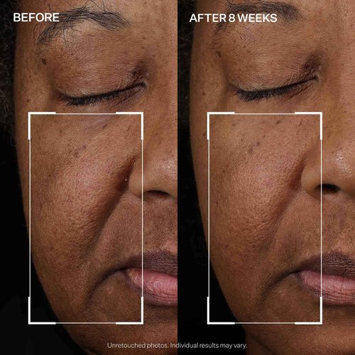 StriVectin Tighten and Lift Peptight Face Lift Serum with Tightening and Brightening Peptides for Wrinkles, Under Eye Bags and Puffiness, 30 mL