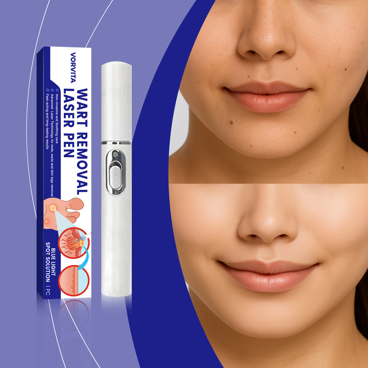 Face Skin Care Laser Pen - Anti-Aging Skin Treatment Tool