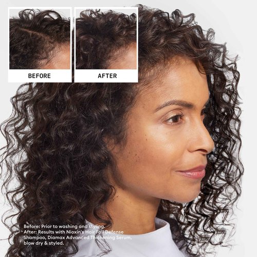 Nioxin Hair Fall Defense Shampoo | Activates Hair Follicles for Visibly Less Hair Loss | With Niacinamide, Caffeine, Lauric Acid, and Sandalore | 33.8 Fl Oz.