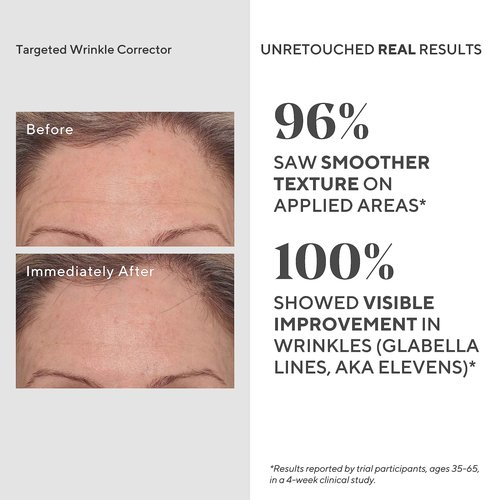 Murad Resurgence Treatment Value Set