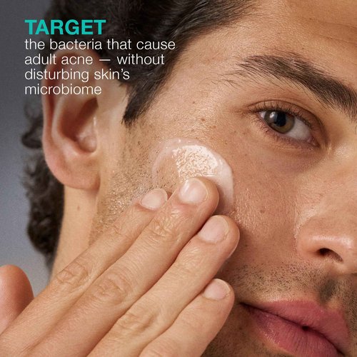 Dermalogica Acne Biotic Face Moisturizer, Lightweight Daily Lotion - Helps with Aging Skin and Prevents Breakouts, 1.7 fl oz