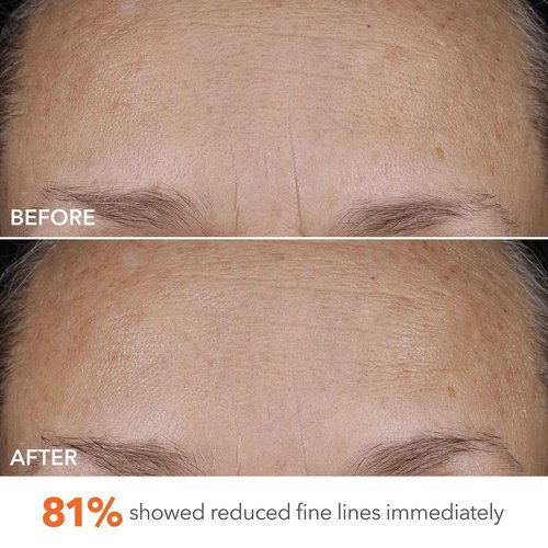 Dr Dennis Gross DermInfusions Blur + Repair Cream, Instantly Blurs Fine Lines, Smooths Skin with Satin-Matte Finish, Visibly Plumps & Firms, Reduces Redness, and Improves Skin Elasticity, 1.7 Fl Oz