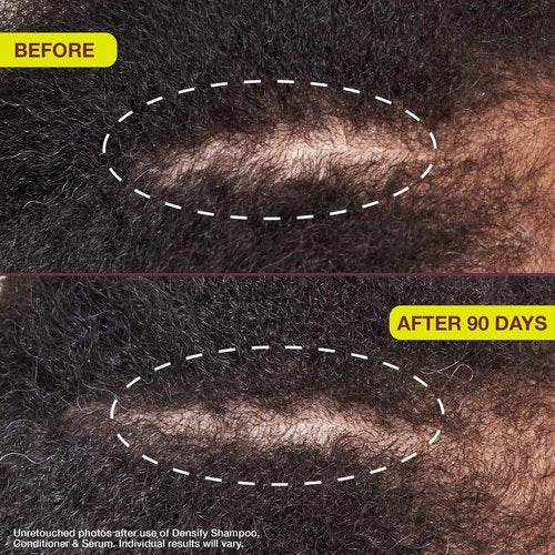 Densifying & Thickening Serum for Thinning Hair, 1oz