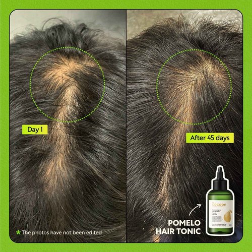 Cocoon Pomelo Oil Hair Tonic. 100% Vegan Scalp Serum Treatment for Thinning, Damaged & Breakage Hair | Soften, Reduce Hair Loss & Promote Hair Growth (4.73 fl oz Each) (3 Boxes)