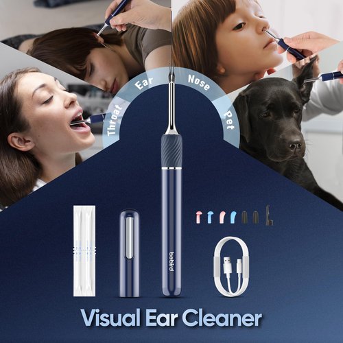 Ear Tweezers with Camera, Note5 Visual Ear Wax Removal Tool Camera with 10 Megapixel Otoscope, 3-in-1 Visual Earwax Cleaning Kit WiFi Ear Cleaning Kit, Ear Camera, Ear Otoscope Camera
