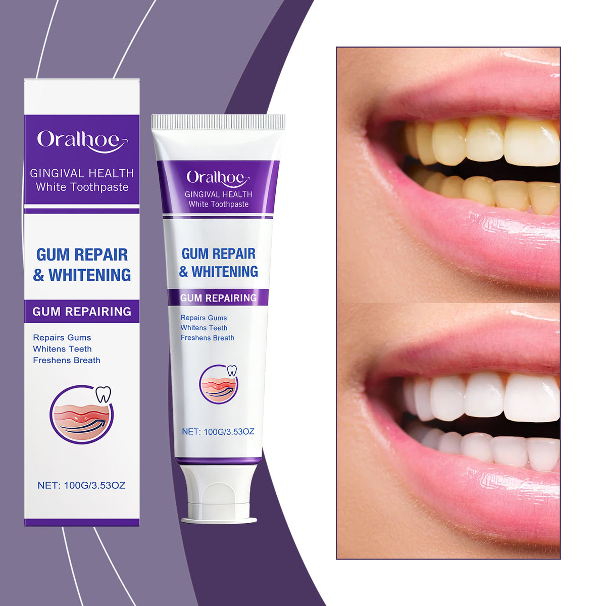 Gingival Repair Toothpaste 100g - Camellia & Chamomile