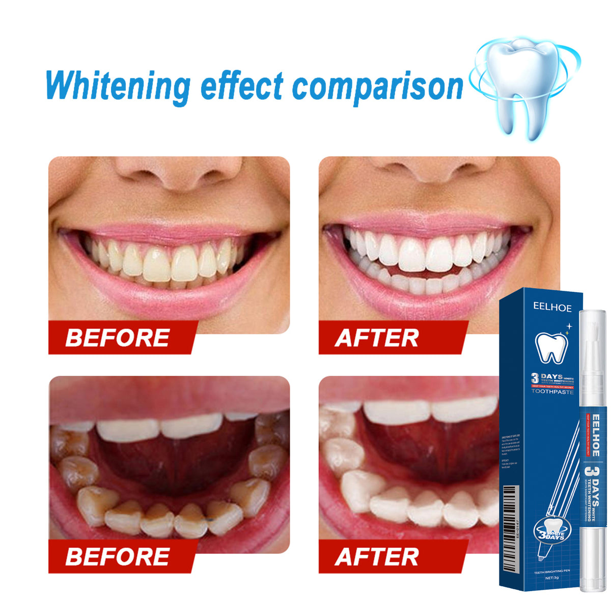 Stain Remover Pen