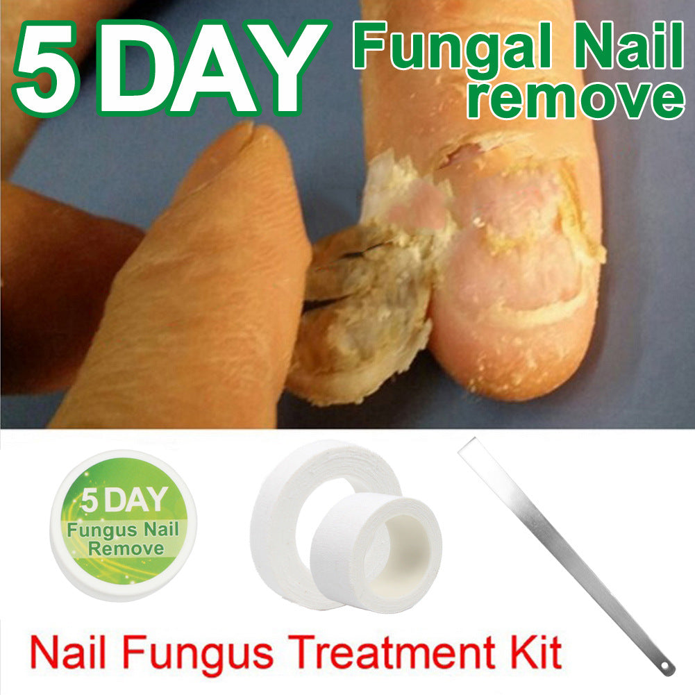 Grey Nail Remover Pedicure Tool Cream - 20g Nail Gel Remover