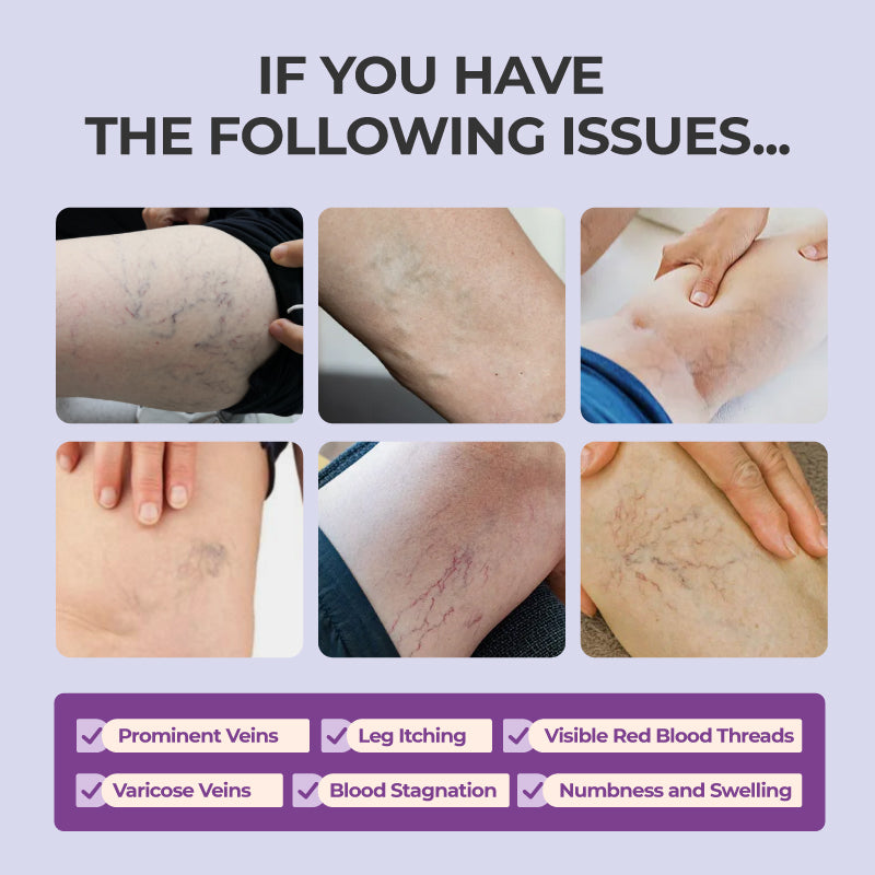 Varicose Vein Relief Cream with Centella Asiatica Root Extract