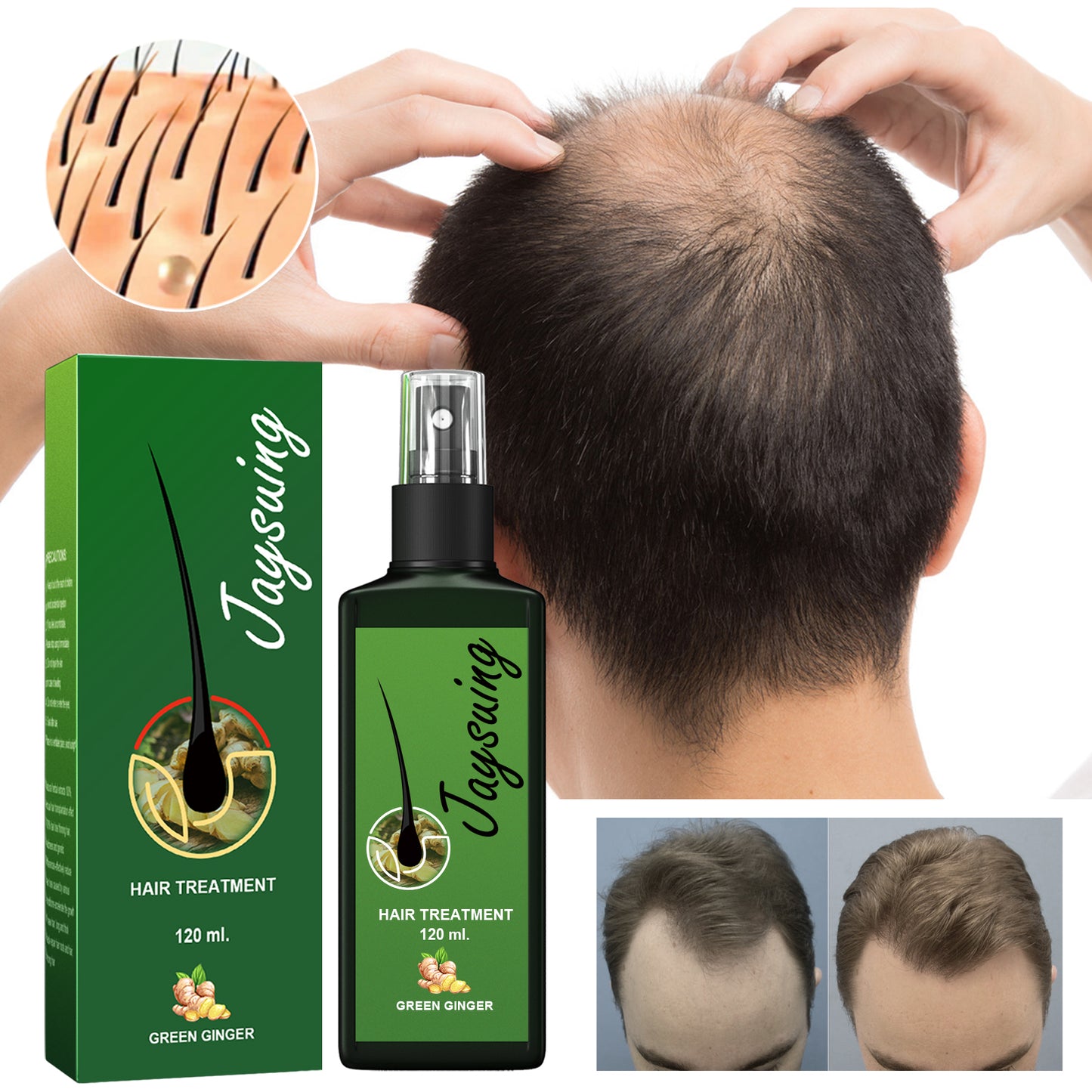 Ginger Hair Growth Treatment Serum - Scalp Nourishing & Strengthening
