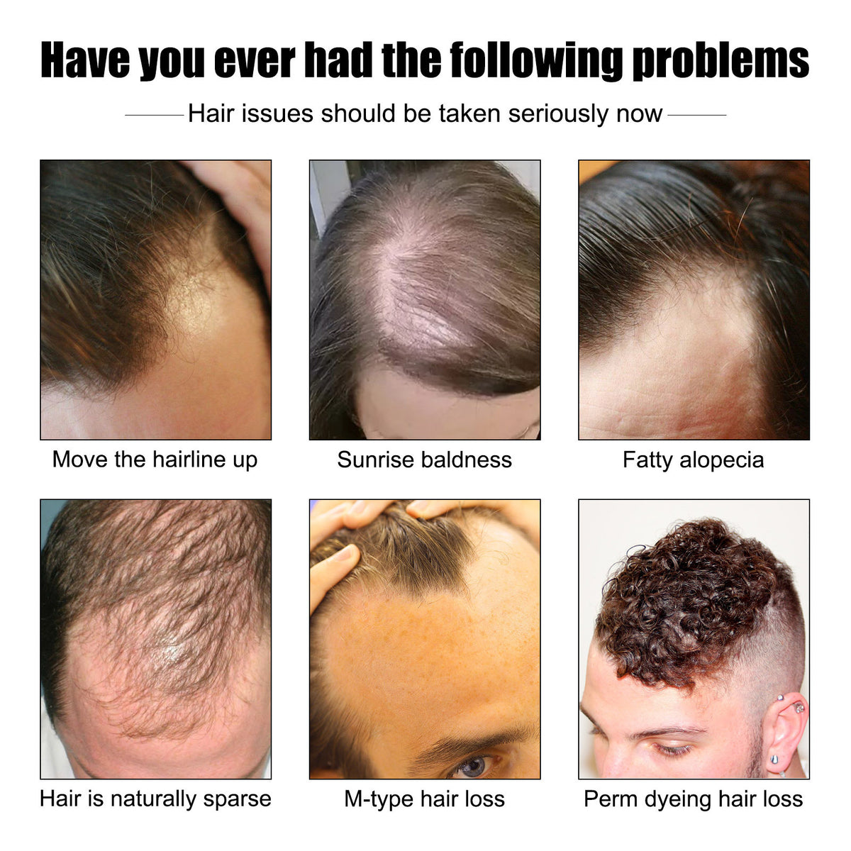 Dense Hair Essence Serum – Nutrition & Growth Support