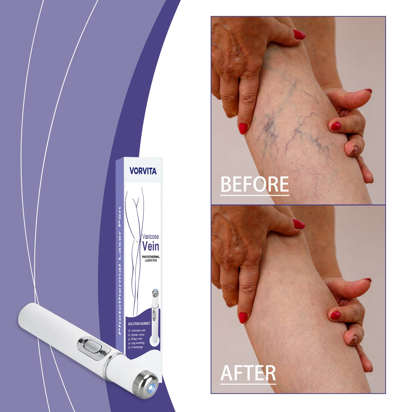 Skin Soothing Care Pen - Gentle Skin Treatment for Relief