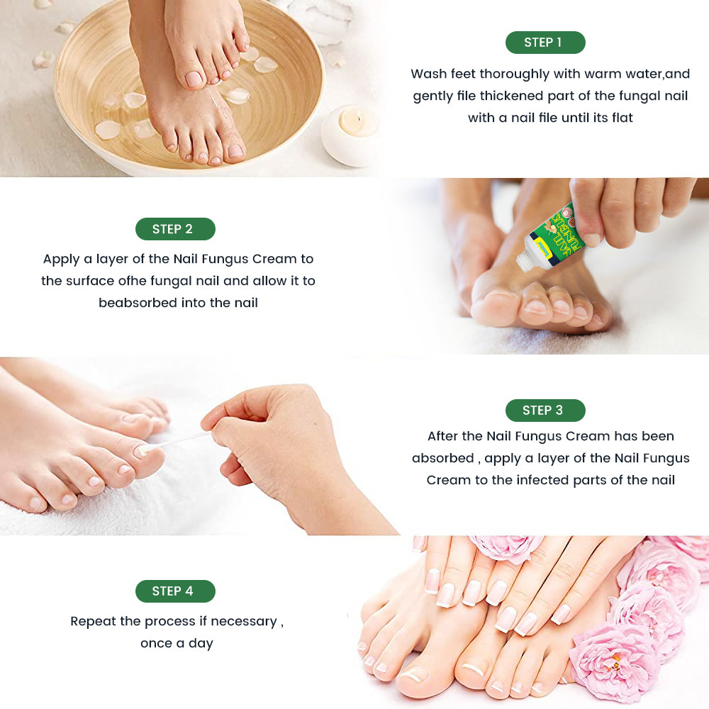 Nail Fungus Repair Treatment Cream - 20g Toe Nail Restoration Gel