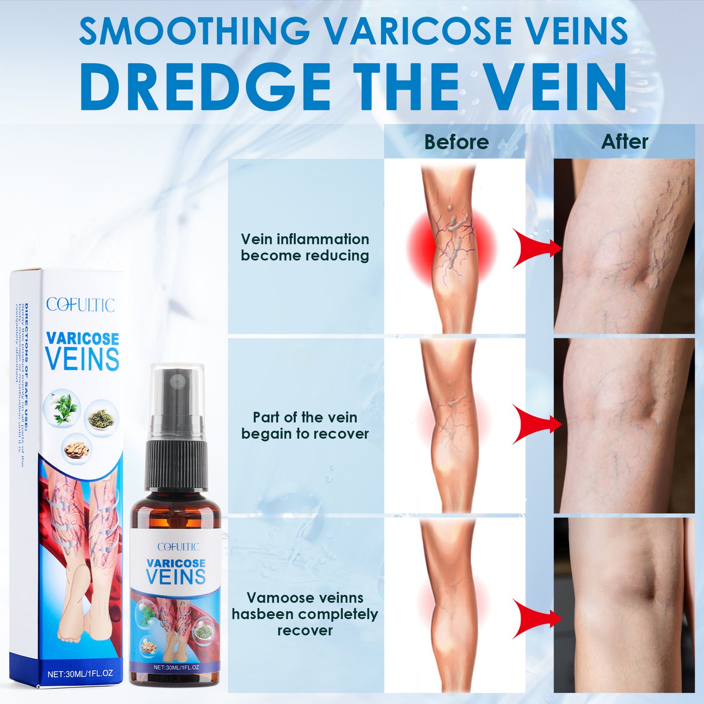 Herbal Varicose Vein Relief Spray - 30ml Leg Care & Circulation Support