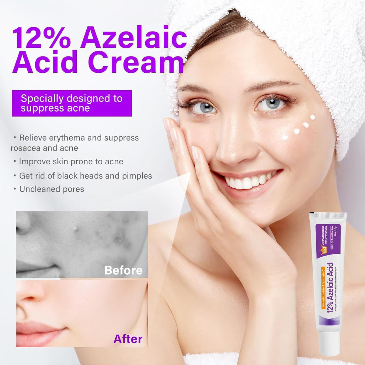 Lo Go Free 12percent Azelaic Acid