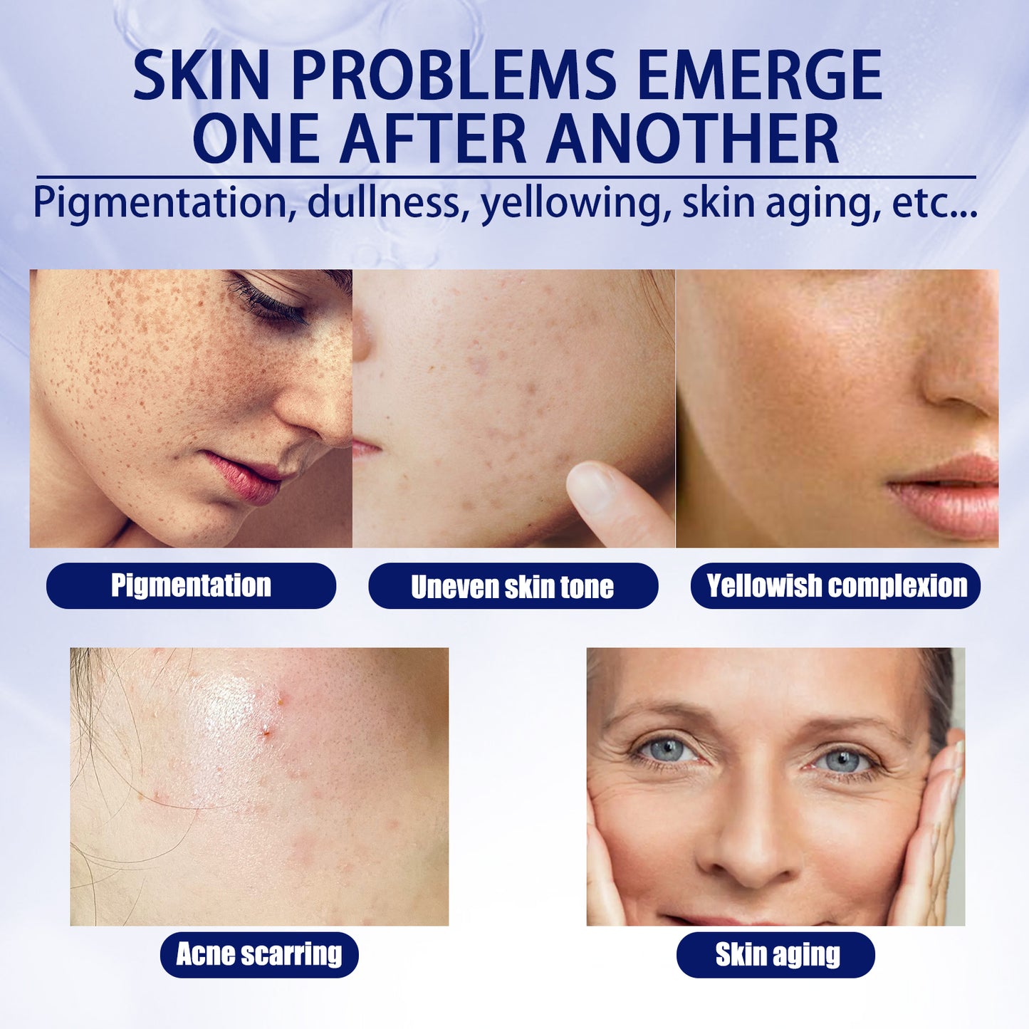 Vitamin C Facial Essence - Anti-Aging Serum for Dark Spots and Fine Lines