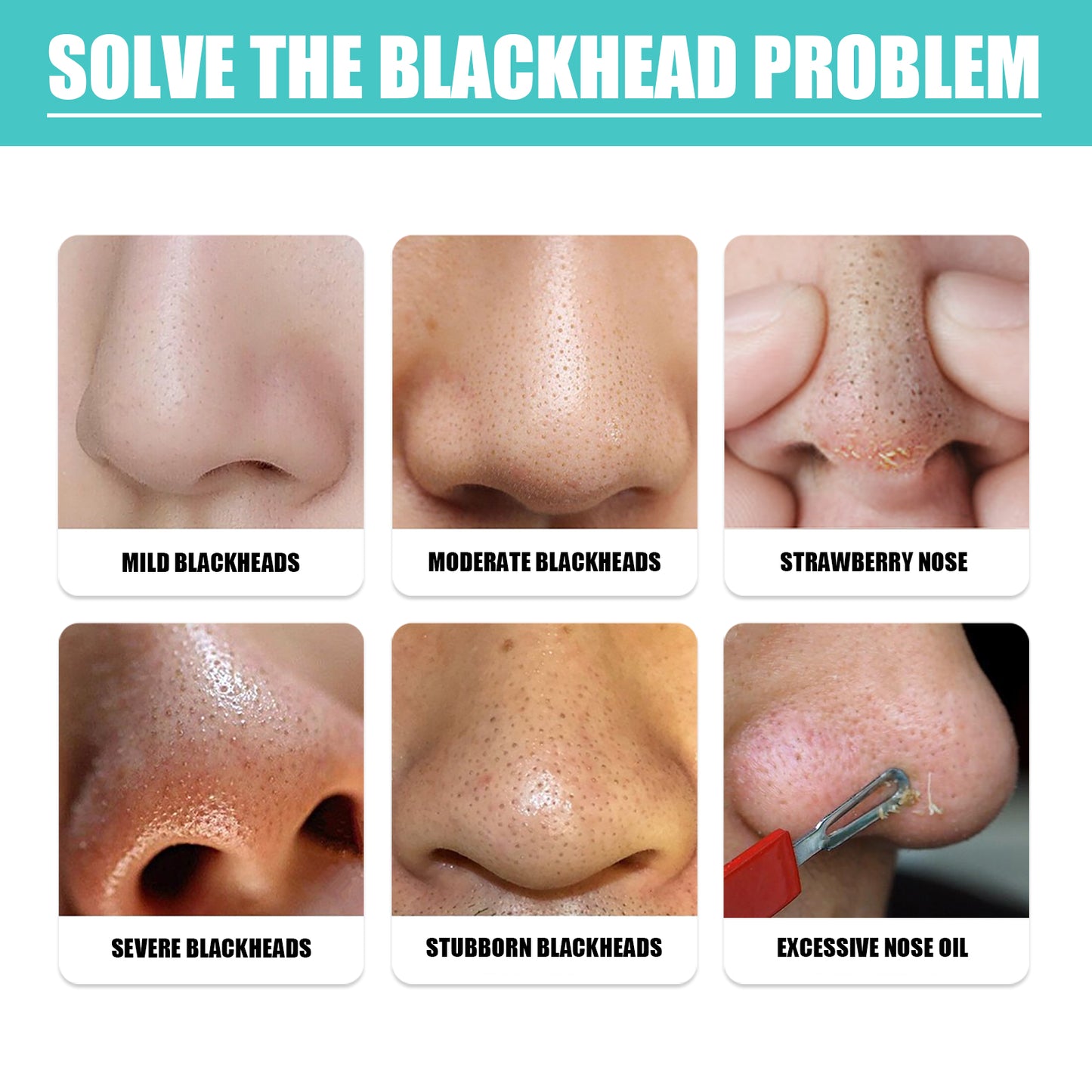Blackhead Removing Nose Mask - Pore Cleansing & Smoothing Liquid Serum
