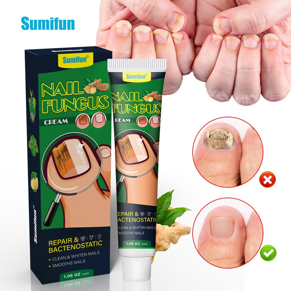 Nail Fungus Repair Treatment Cream - 20g Toe Nail Restoration Gel