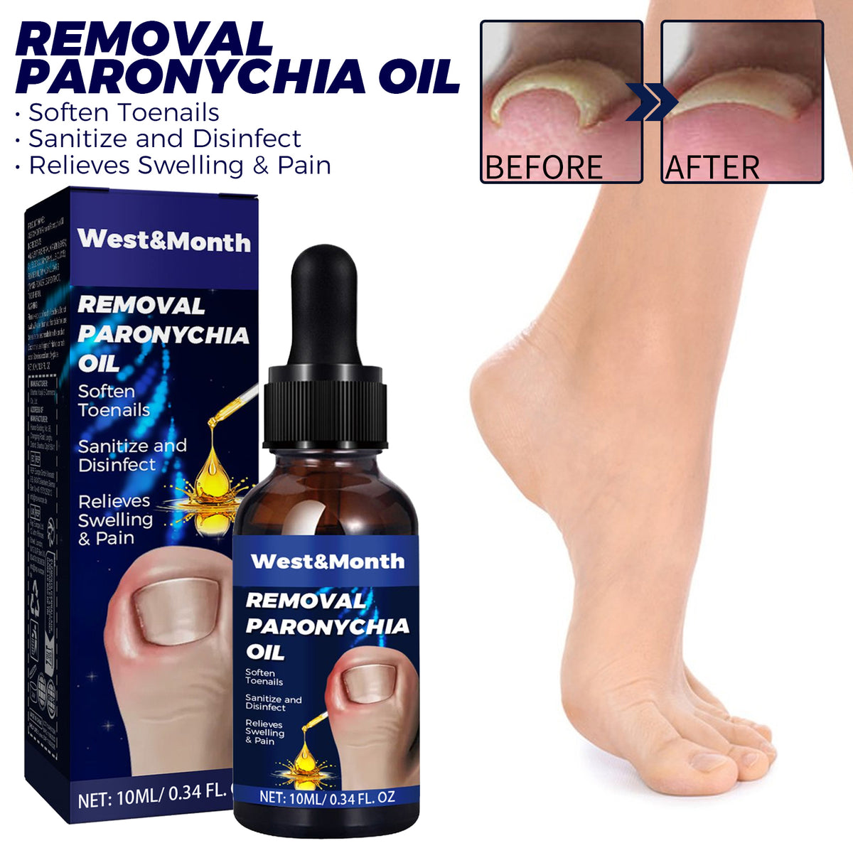 Nail Care Oil 10ml - Toenail & Cuticle Treatment