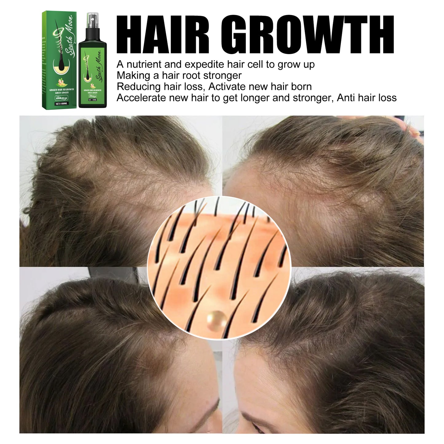 Hair Growth Spray - Scalp Nourishing & Strengthening Treatment