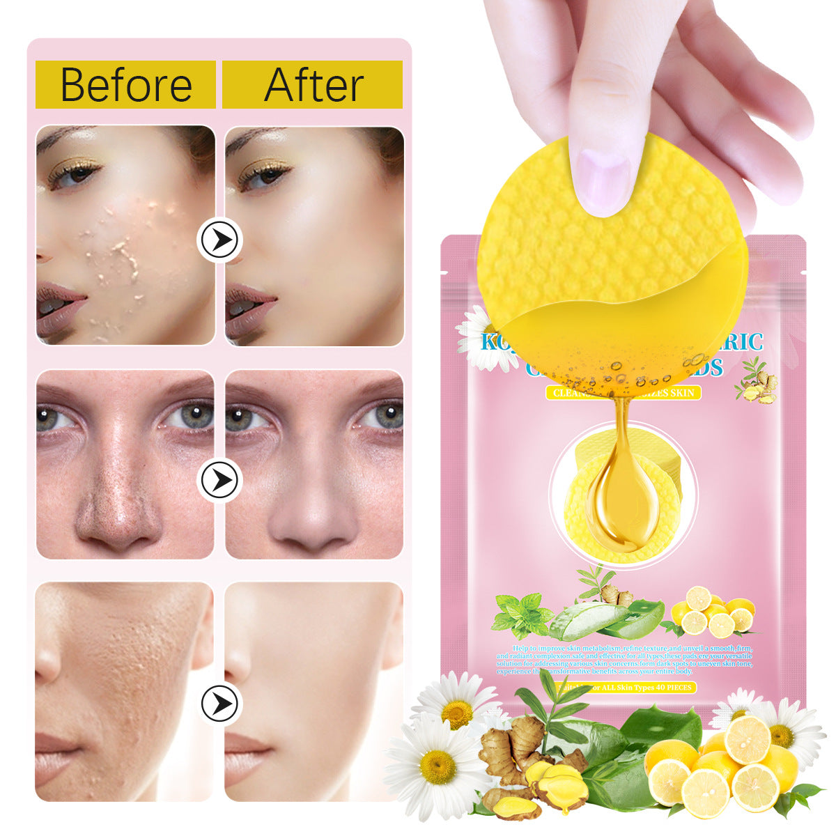 Turmeric Kojic Acid Cleansing Pads - Oil Control Facial Cleanser 40pcs