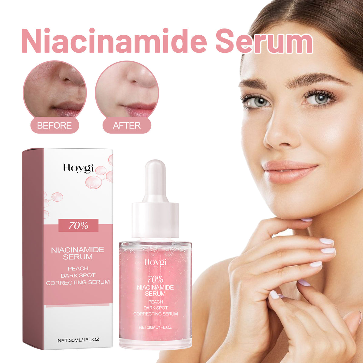 Nicotinamide Hydrating Skin Care Solution for Moisturizing - 30ml