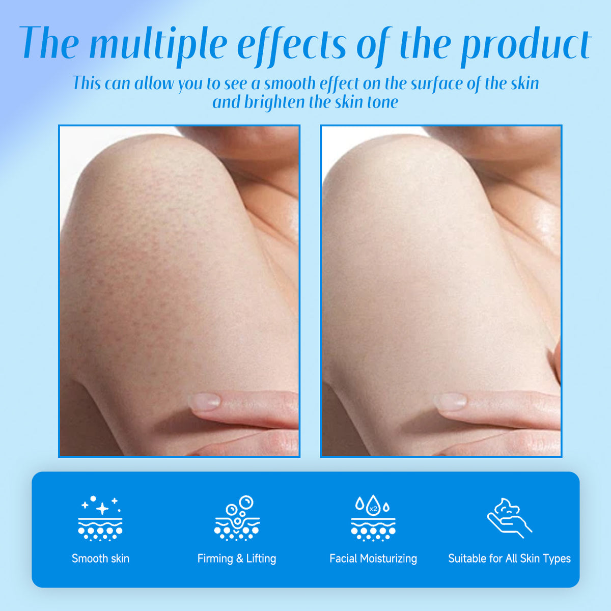 Keratosis Pilaris Repair Cream - Urea Exfoliating Body Lotion