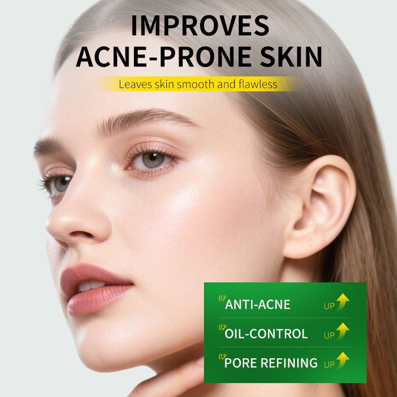 Salicylic Acid Acne Cream 30g