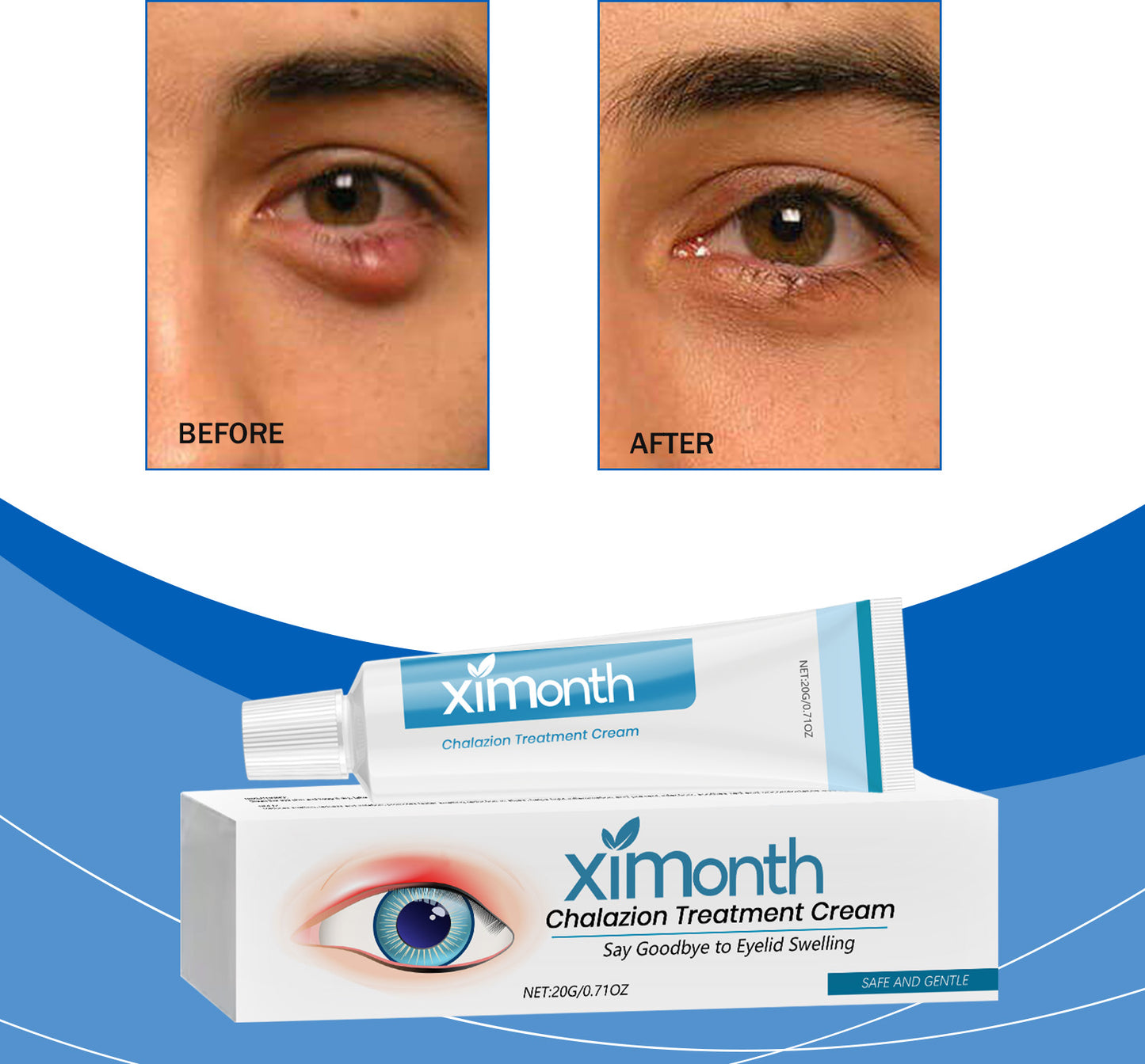 Eye Soothing Cream 20g - Gentle Eye Care for Sensitive Skin