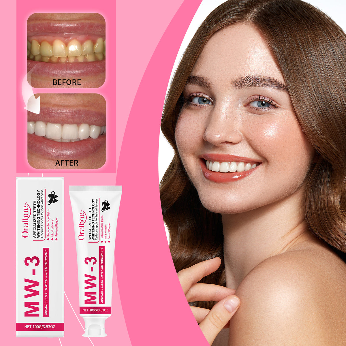 Whitening & Stain-Removing Toothpaste 100g